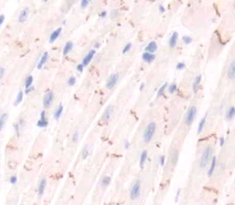 Polyclonal Antibody to Endothelial NOS (eNOS)