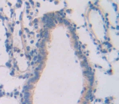 Polyclonal Antibody to Endothelial NOS (eNOS)