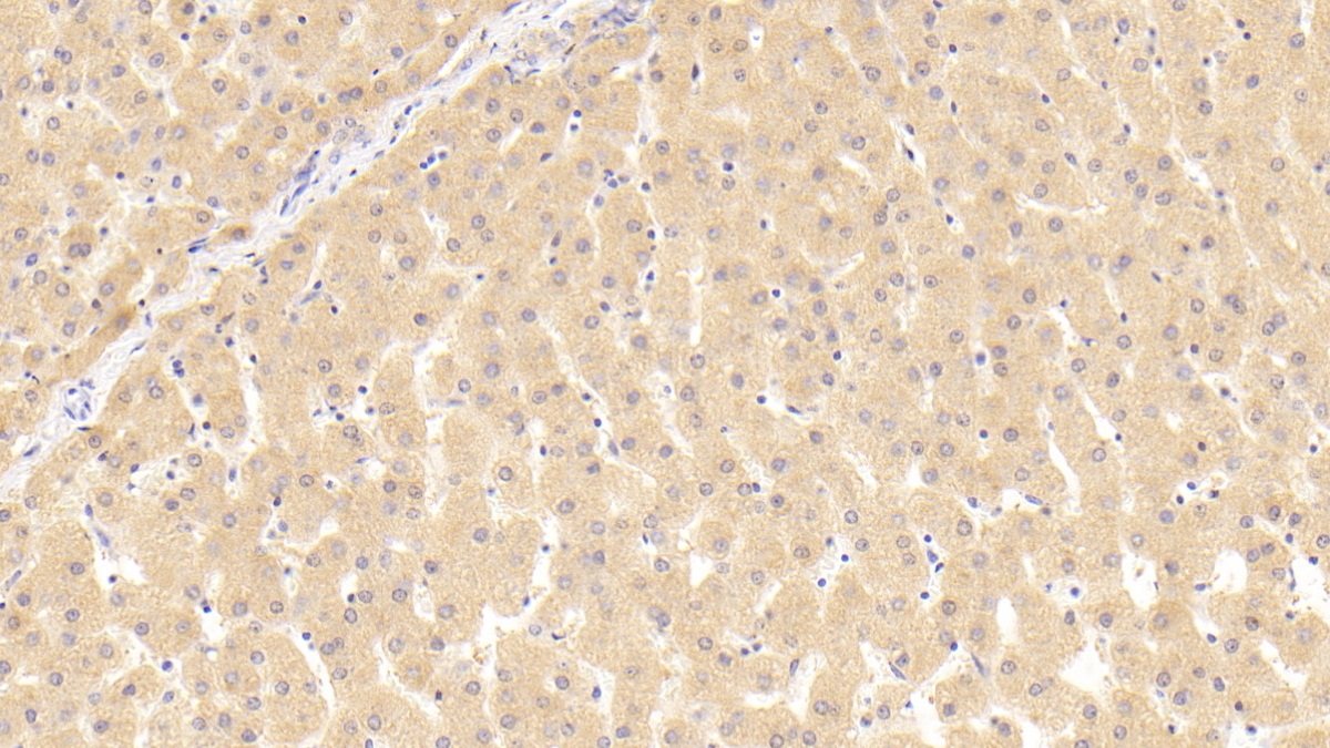 Polyclonal Antibody to Thyroid Hormone Receptor Beta (THRb)