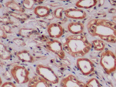 Polyclonal Antibody to Anaplastic Lymphoma Kinase (ALK)