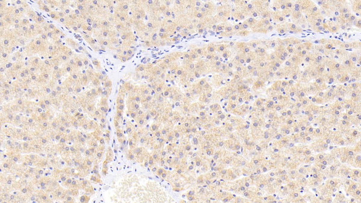 Polyclonal Antibody to Heat Shock Protein Beta 2 (HSPb2)