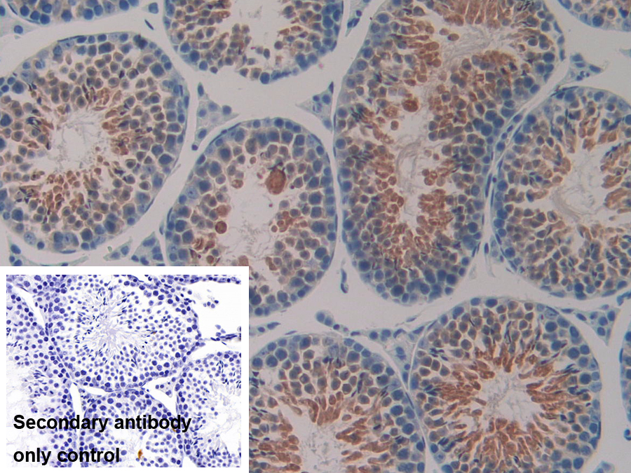 Polyclonal Antibody to Heat Shock Protein 40 (HSP40)