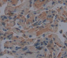 Polyclonal Antibody to Calcitonin Gene Related Peptide (CGRP)