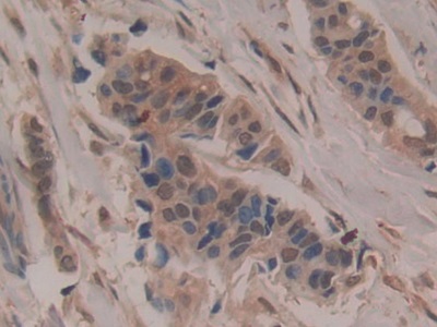 Polyclonal Antibody to Cluster Of Differentiation 200 (CD200)