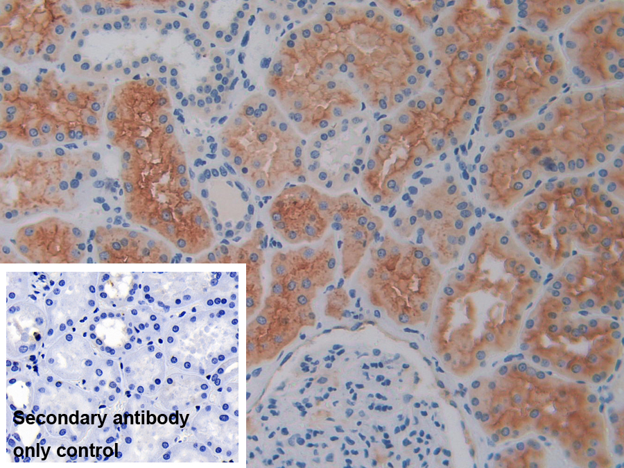 Polyclonal Antibody to Cluster Of Differentiation 26 (CD26)