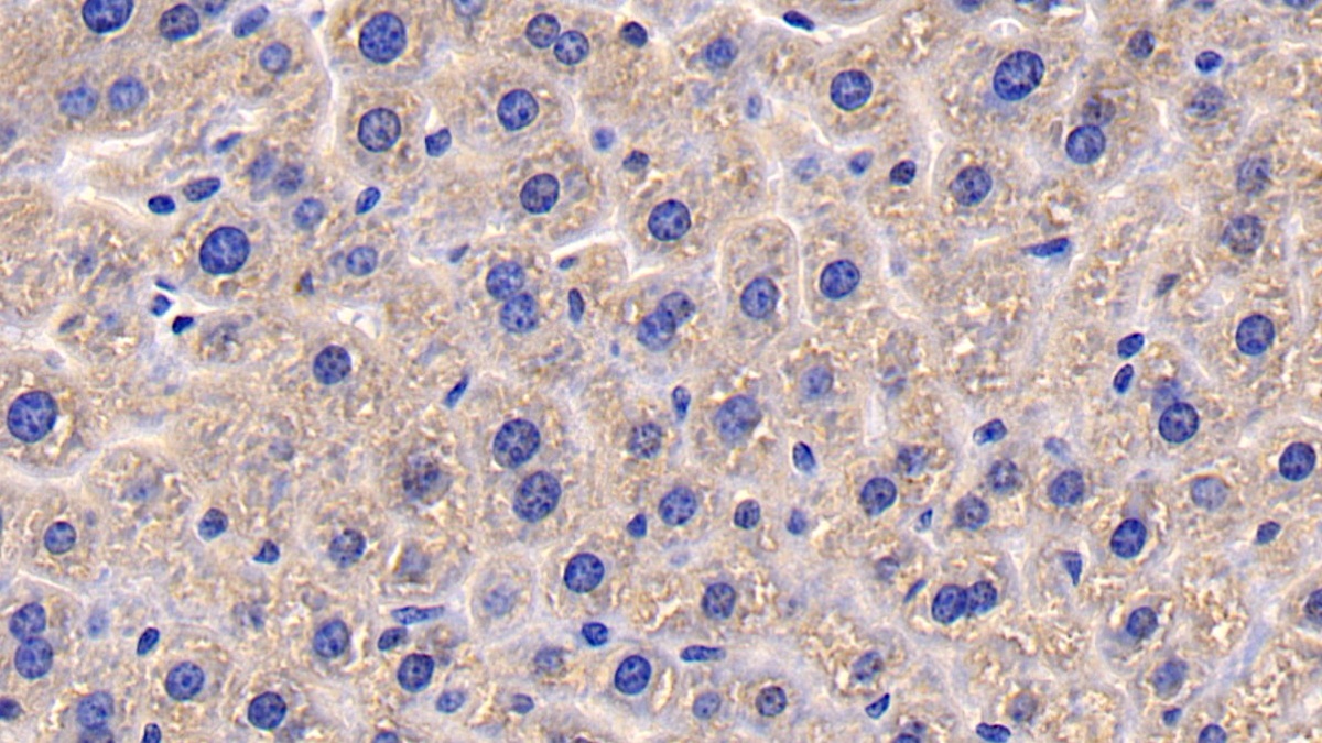 Polyclonal Antibody to Cluster Of Differentiation 26 (CD26)