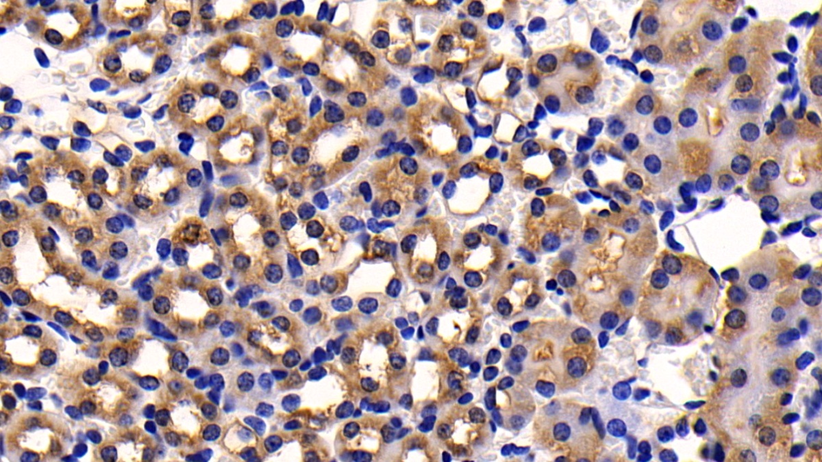 Polyclonal Antibody to Cluster Of Differentiation 26 (CD26)