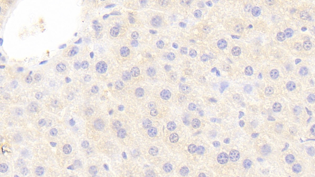 Polyclonal Antibody to Serum Amyloid A (SAA)