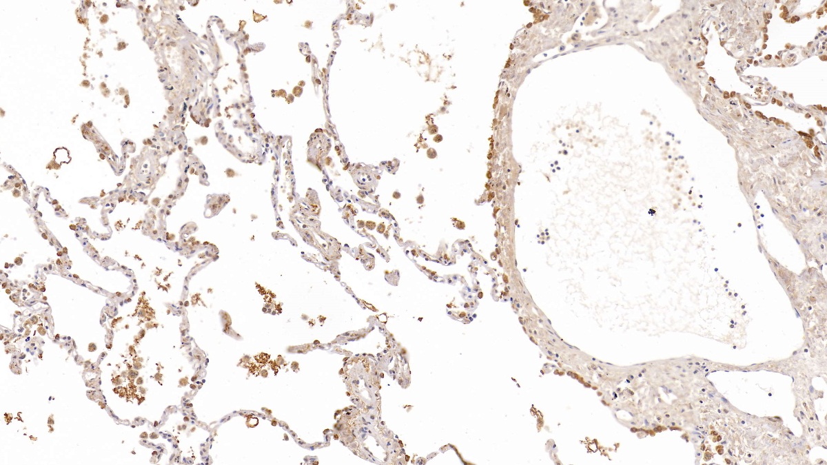 Polyclonal Antibody to Pulmonary Surfactant Associated Protein A1 (SFTPA1)