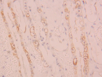 Polyclonal Antibody to Arachidonate-15-Lipoxygenase (ALOX15)