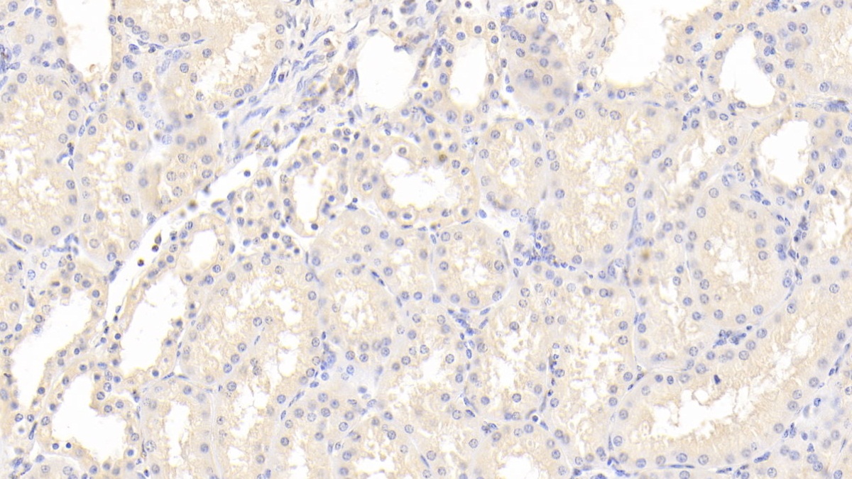 Polyclonal Antibody to Insulin Receptor (INSR)