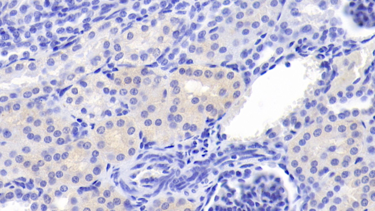 Polyclonal Antibody to Cystatin C (Cys-C)