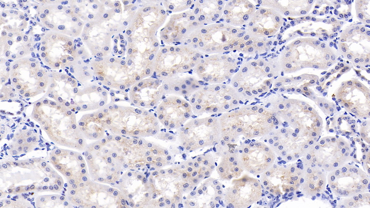 Polyclonal Antibody to Osteopontin (OPN)