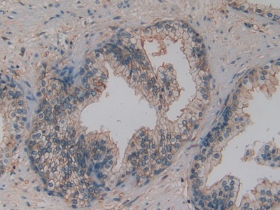 Polyclonal Antibody to Osteopontin (OPN)