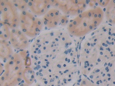 Polyclonal Antibody to Osteopontin (OPN)