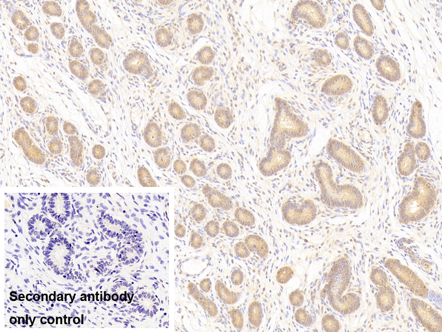 Polyclonal Antibody to Protein Tyrosine Phosphatase Receptor Type M (PTPRM)