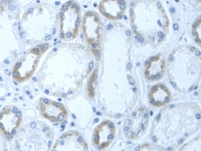 Polyclonal Antibody to Dihydrolipoyl Dehydrogenase (DLD)