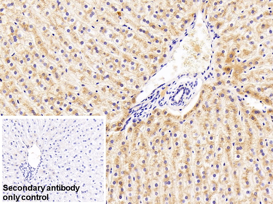 Polyclonal Antibody to Retinol Binding Protein 4 (RBP4)