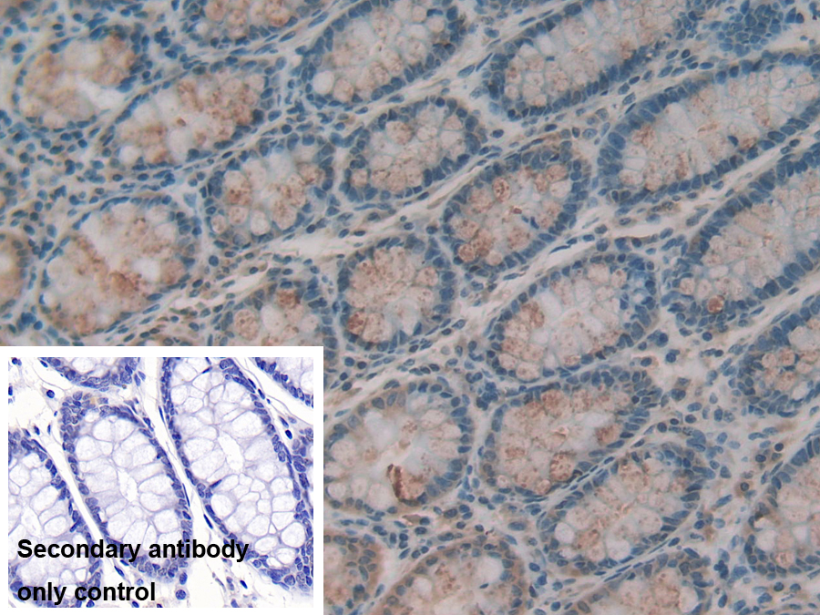 Polyclonal Antibody to Intelectin 1 (ITLN1)