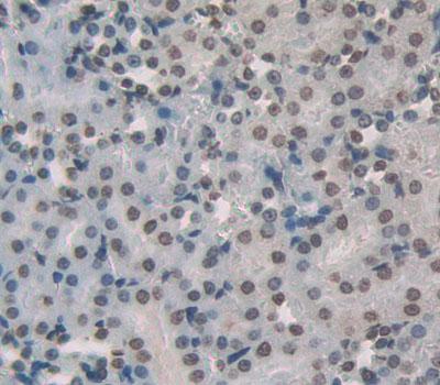 Polyclonal Antibody to Peroxisome Proliferator Activated Receptor Alpha (PPARa)