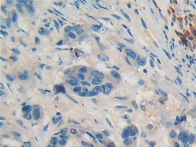 Polyclonal Antibody to Immunoglobulin Lambda Like Polypeptide 1 (IglL1)