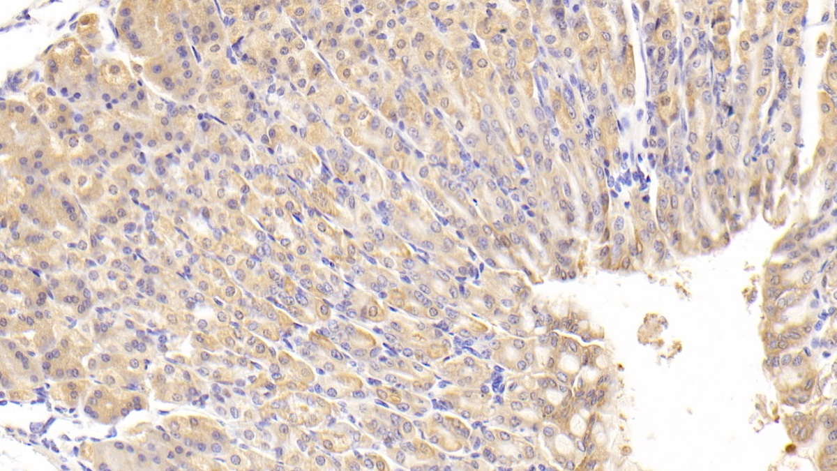 Polyclonal Antibody to Immunoglobulin Lambda Like Polypeptide 1 (IglL1)