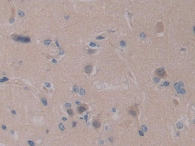 Polyclonal Antibody to Pre-B-Lymphocyte Gene 1 (VPREB1)