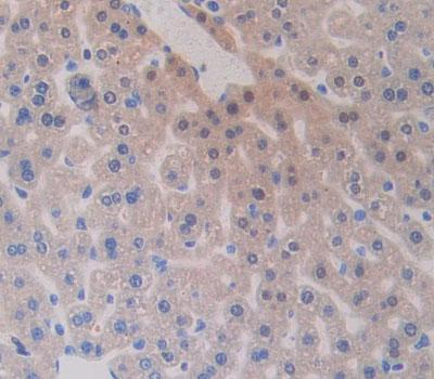 Polyclonal Antibody to Pre-B-Lymphocyte Gene 1 (VPREB1)