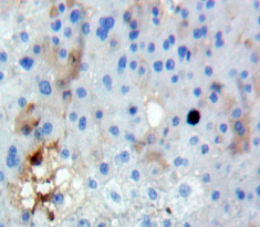 Polyclonal Antibody to Fucosyltransferase 3 (FUT3)