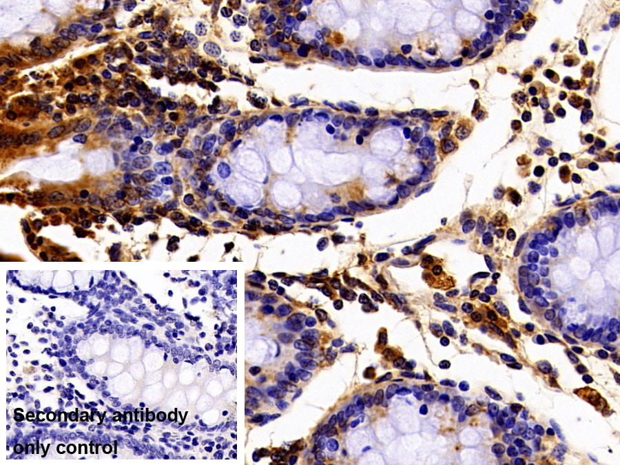 Polyclonal Antibody to Thymidine Phosphorylase (TP)