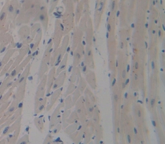 Polyclonal Antibody to Signal Regulatory Protein Beta 1 (SIRPb1)