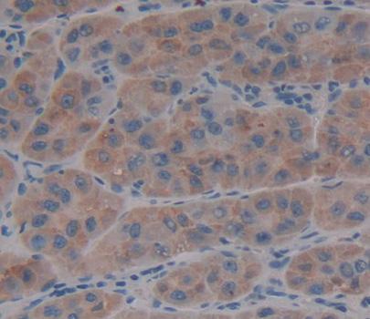 Polyclonal Antibody to Von Willebrand Factor Cleaving Protease (vWFCP)