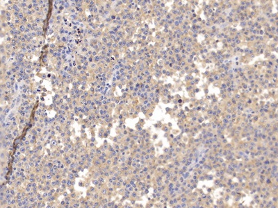 Polyclonal Antibody to Cluster Of Differentiation 6 (CD6)