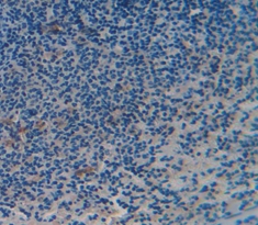 Polyclonal Antibody to Cluster Of Differentiation 6 (CD6)