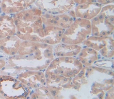 Polyclonal Antibody to L1-Cell Adhesion Molecule (L1CAM)