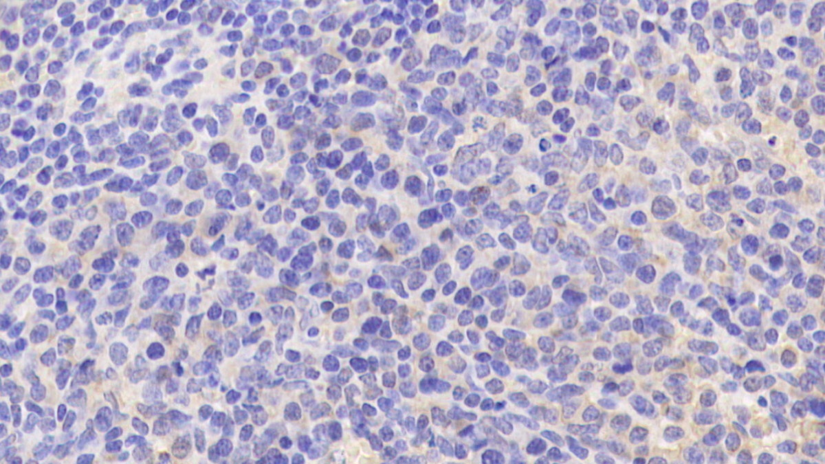 Polyclonal Antibody to Sialic Acid Binding Ig Like Lectin 5 (SIGLEC5)