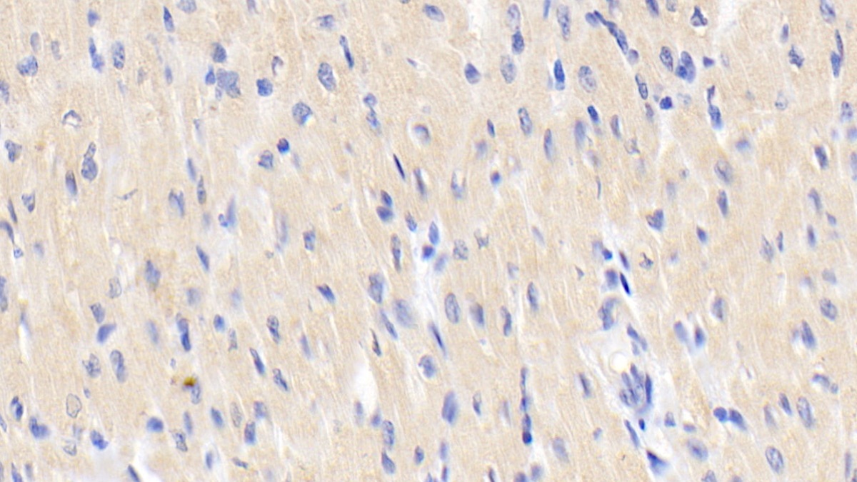 Polyclonal Antibody to Activin A Receptor Type I (ACVR1)