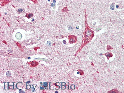 Polyclonal Antibody to Discoidin Domain Containing Receptor 2 (DDR2)