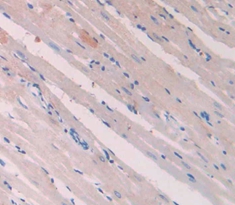 Polyclonal Antibody to Retinoic Acid Receptor Alpha (RARa)