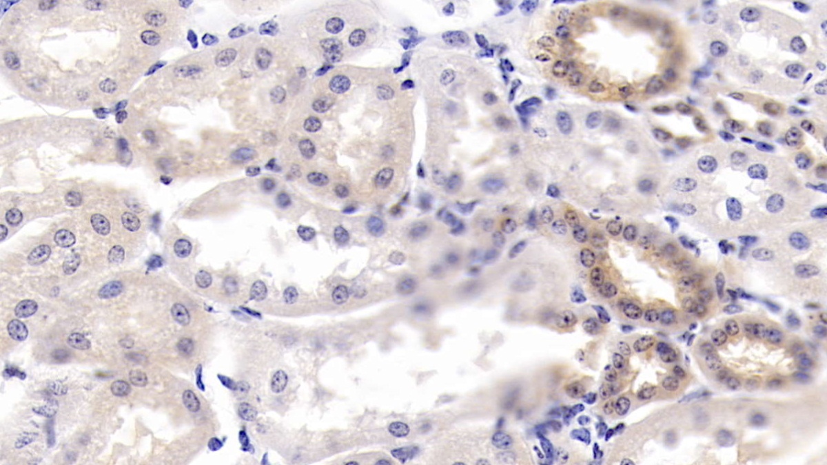 Polyclonal Antibody to Cyclophilin A (CYPA)