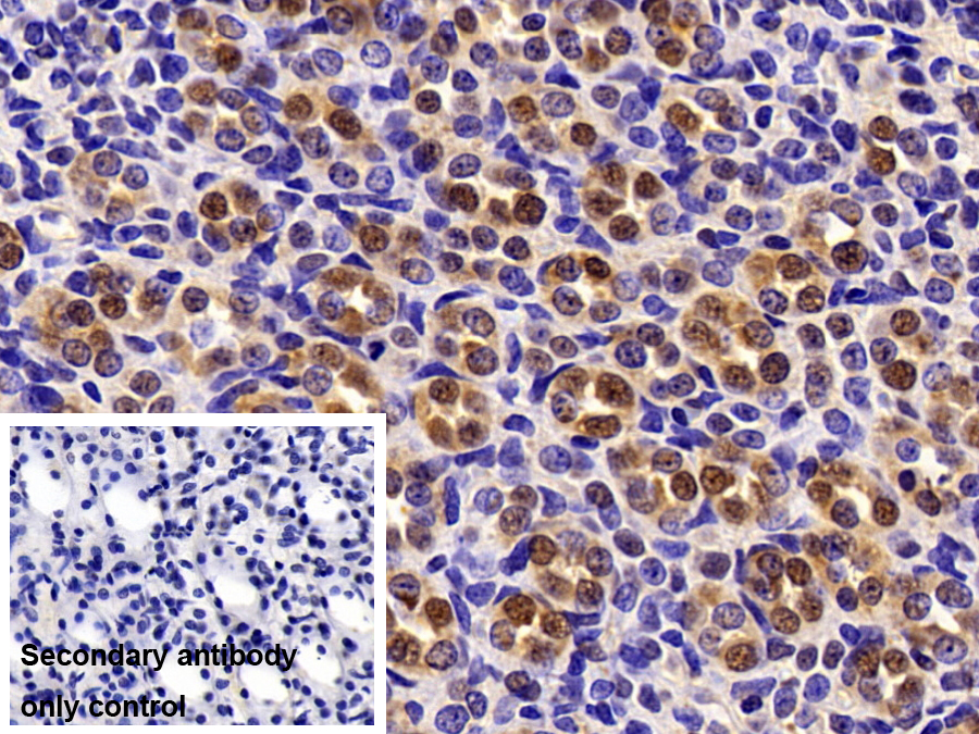 Polyclonal Antibody to Cyclophilin A (CYPA)