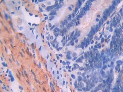 Polyclonal Antibody to Endoglin (ENG)