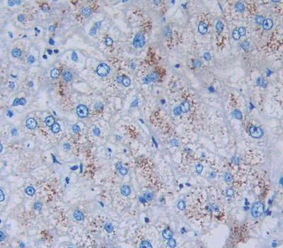 Polyclonal Antibody to Cholinergic Receptor, Nicotinic, Alpha 1 (CHRNa1)