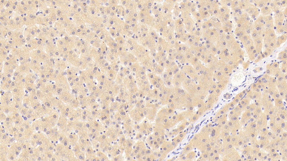 Polyclonal Antibody to Protein Tyrosine Phosphatase Receptor Type H (PTPRH)