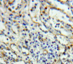 Polyclonal Antibody to P-Selectin Glycoprotein Ligand 1 (PSGL1)