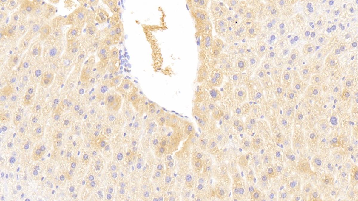 Polyclonal Antibody to Cytochrome P450 2E1 (CYP2E1)