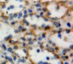 Polyclonal Antibody to Cluster Of Differentiation 160 (CD160)