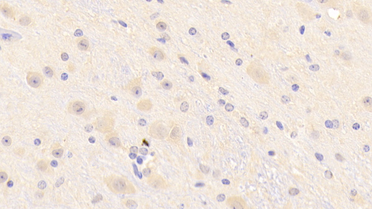 Polyclonal Antibody to Cluster Of Differentiation 160 (CD160)