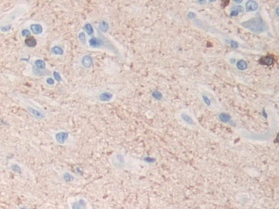 Polyclonal Antibody to Tubulin Polymerization Promoting Protein (TPPP)