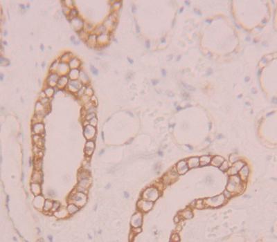 Polyclonal Antibody to Protein Zero, Myelin (MPZ)